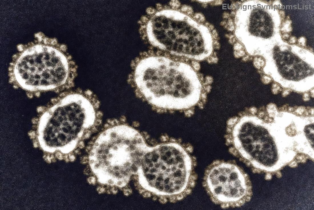 Παραδείγματα γευμάτων για μακροχρόνια διατροφή μετά καρκίνο στομάχου