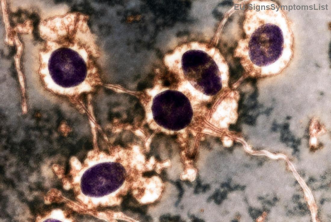 Rodina podporující pacienta s melanomem během léčby