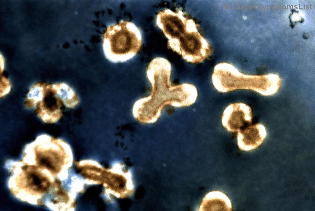 Dieta e balancuar me fruta, perime dhe proteina për pacientët me kancer limfom