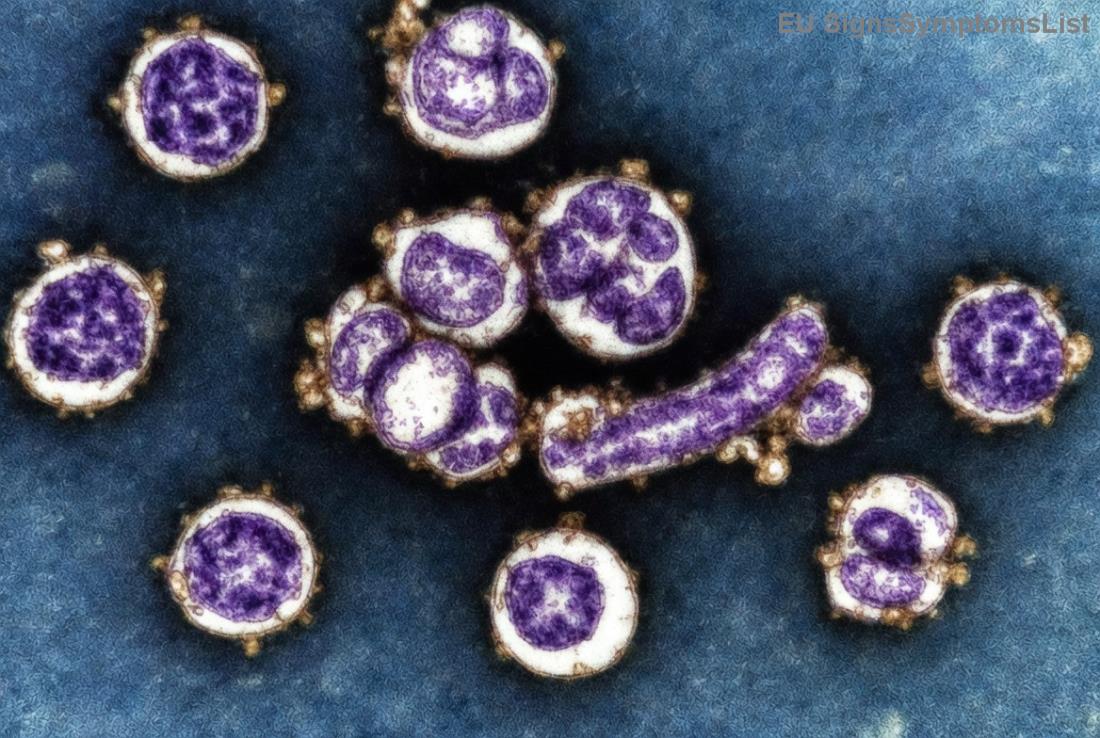 Húgyhólyagrák diéta: Antioxidánsokban gazdag ételek a stressz és a tünetek ellen