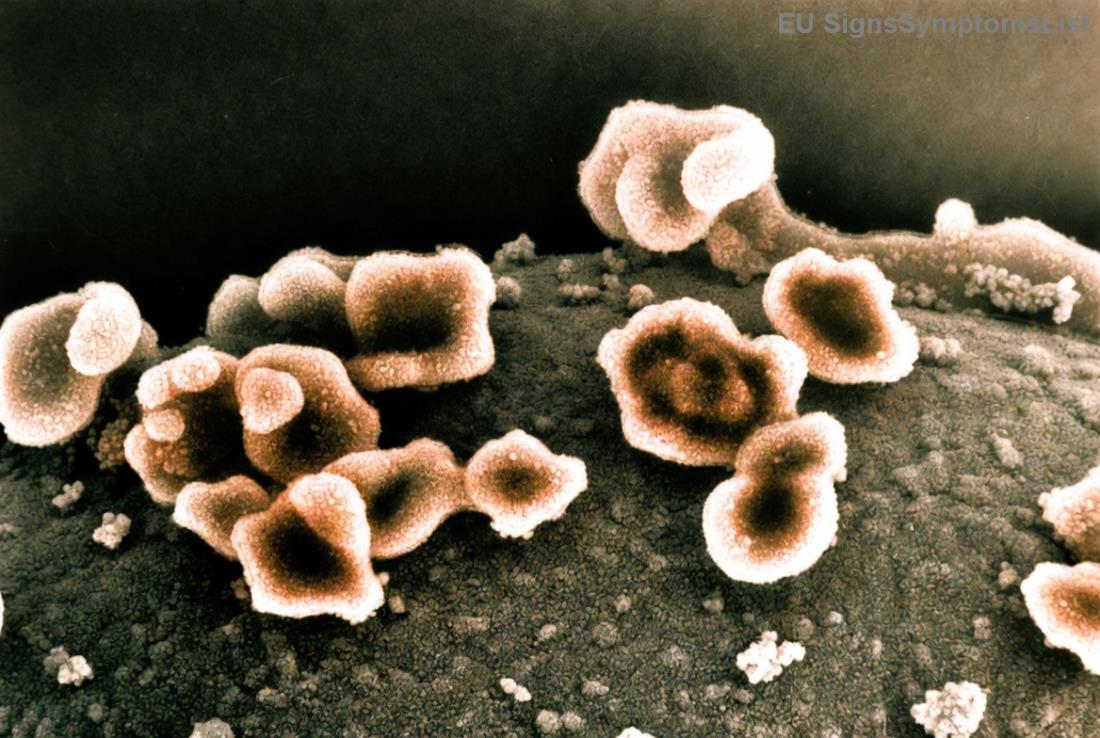 <strong>Cvičení po hysterektomii</strong> pro podporu pánevního dna a celkové kondice