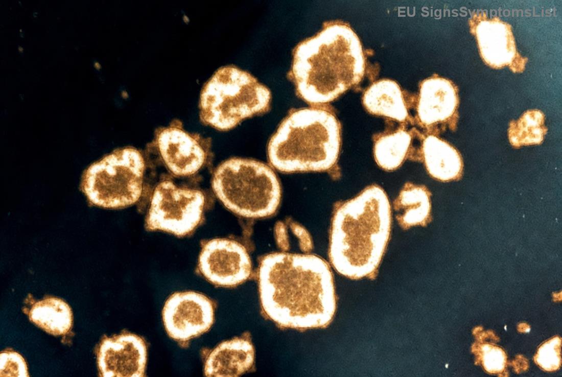 Tabulka protizánětlivých potravin pro podporu při melanomu