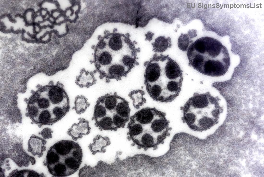 Ilustracija hirurškog lečenja lokalizovanog raka bubrega