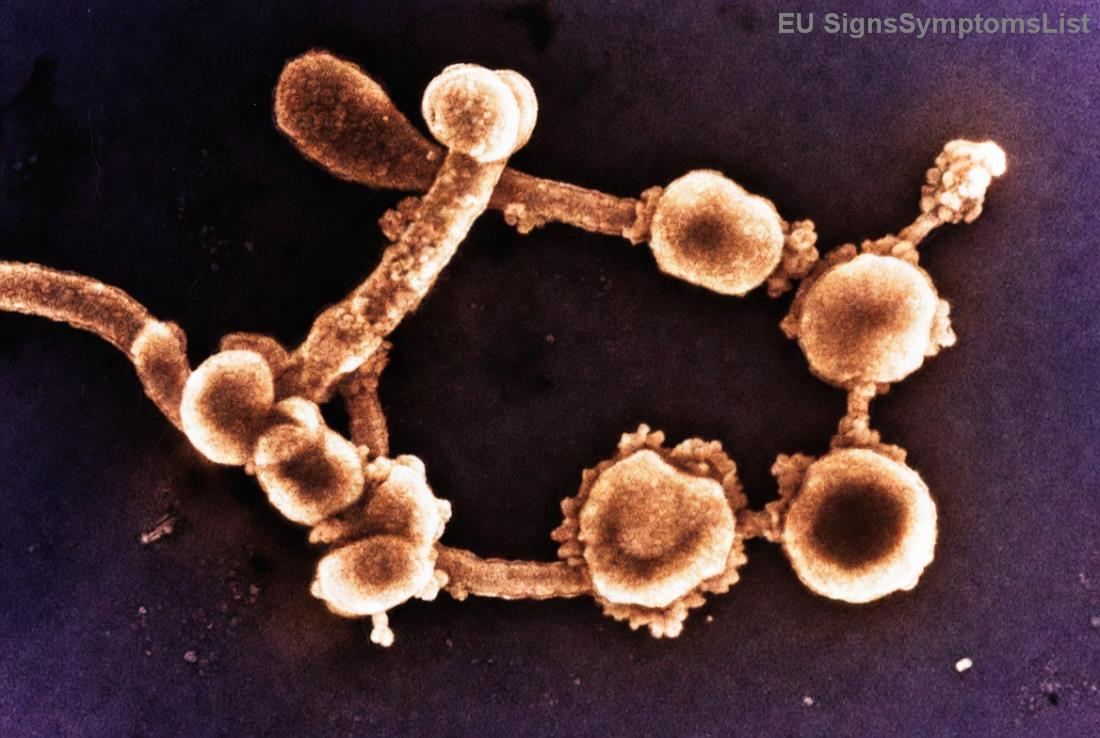 Διατροφή κατά της ναυτίας και ενίσχυση ανοσοποιητικού