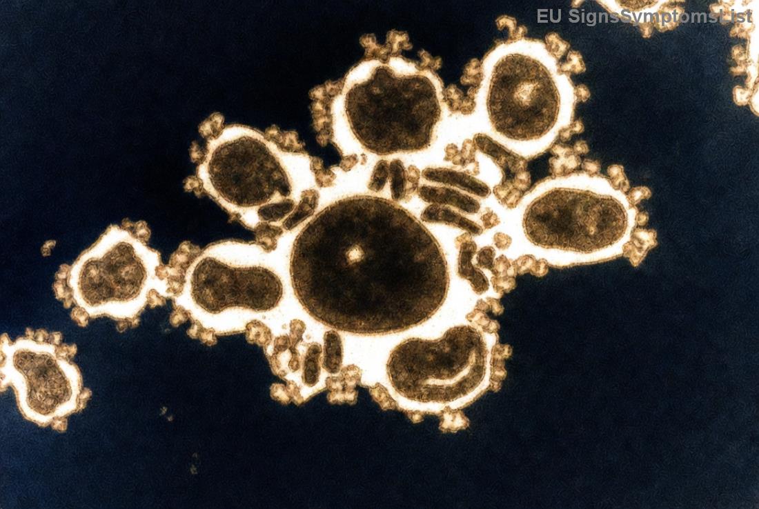 Super hrana za jačanje tokom hemoterapije kod Limfoma Hodžkina