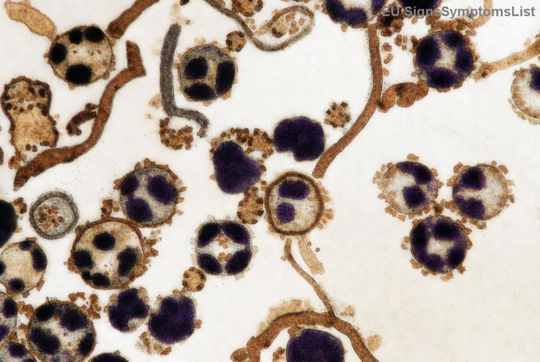 Zdrava ishrana za pacijente sa rakom jajnika