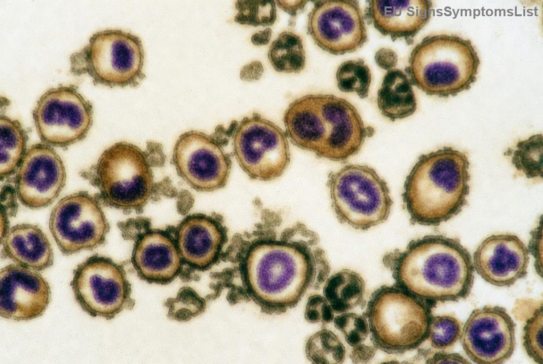 Διατροφή για καρκίνο και υγεία νεφρών