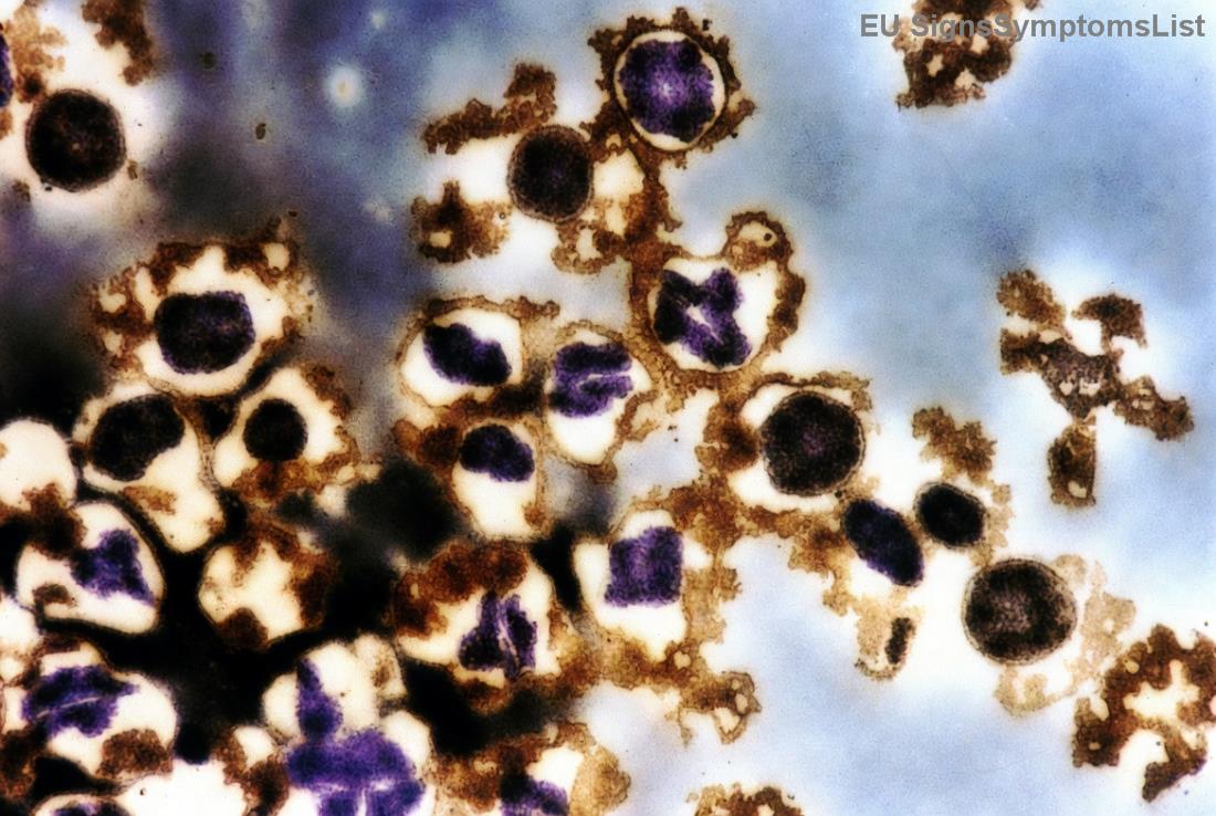 Διατροφή και θεραπεία καρκίνου τραχήλου μήτρας