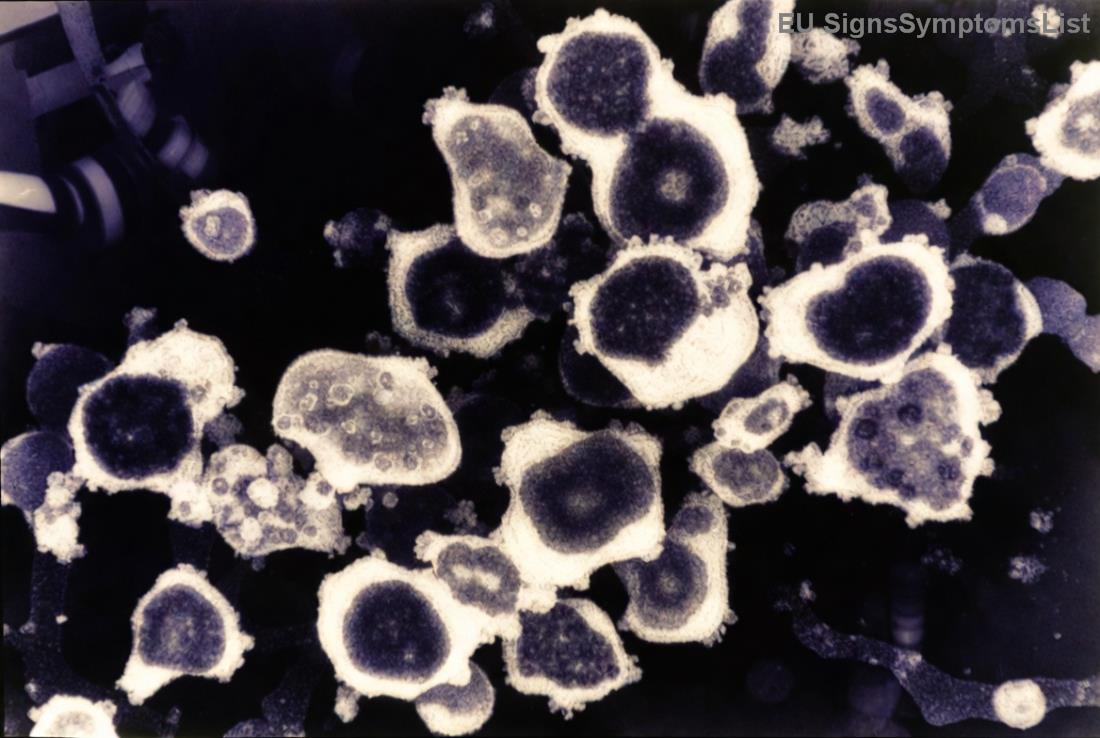 Mitovi o šećeru i raku pluća razbijeni