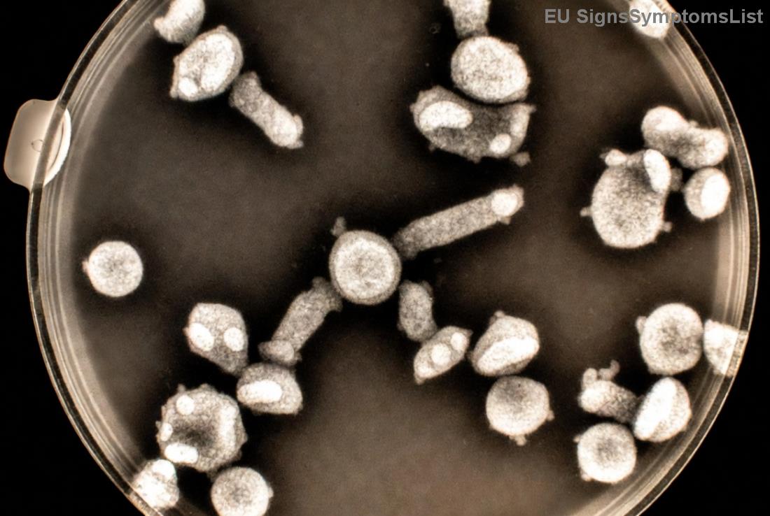 Hasnyálmirigyrák kezelési stratégiák és étrend