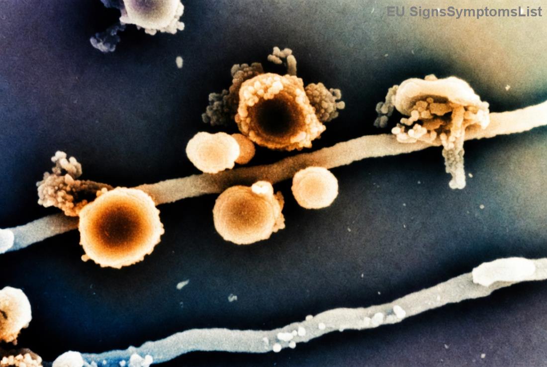 Pokročilá rakovina endometria stadium 3 - léčba a naděje na vyléčení