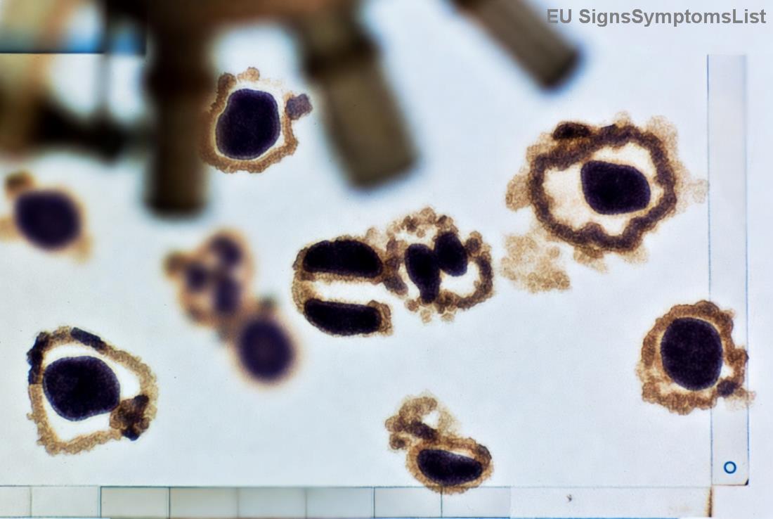 Superhrana za hormonalnu ravnotežu kod raka