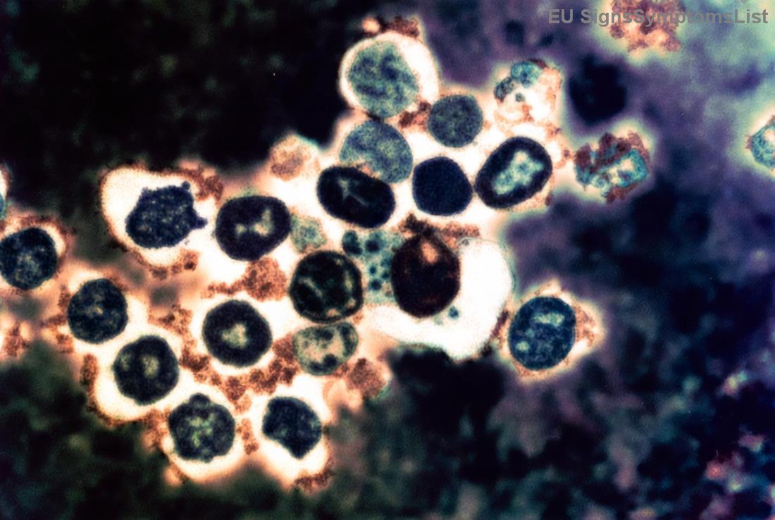 Mintamenü petefészekrák étrendhez puffadás ellen