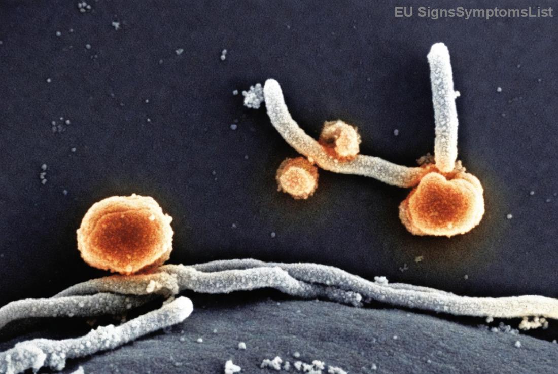 Εικόνες θεραπείας και διατροφής για καρκίνο ουροδόχου κύστης