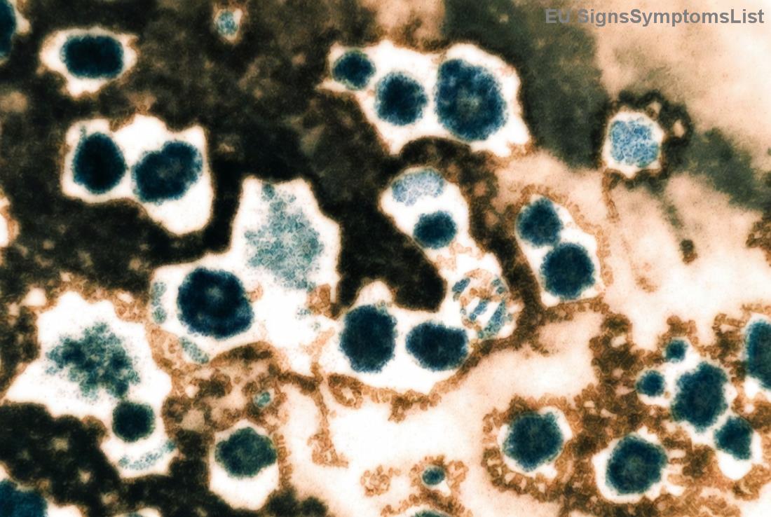 Παράδειγμα μενού διατροφής φιλικής προς νεφρά για ασθενείς καρκίνου