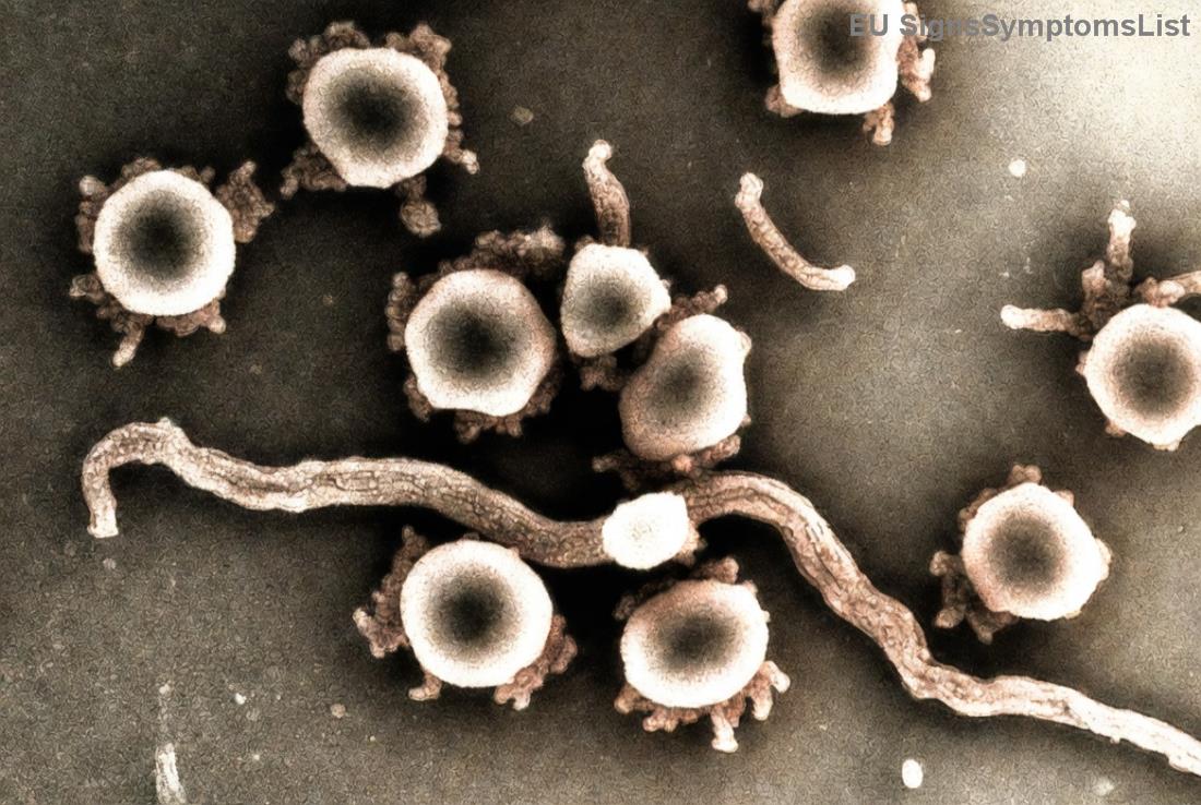 Ελπίδα θεραπείας προχωρημένου καρκίνου ενδομητρίου