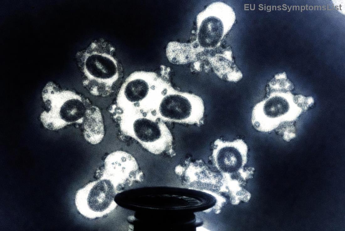 <strong>Ishrana</strong> za oporavak od raka želuca