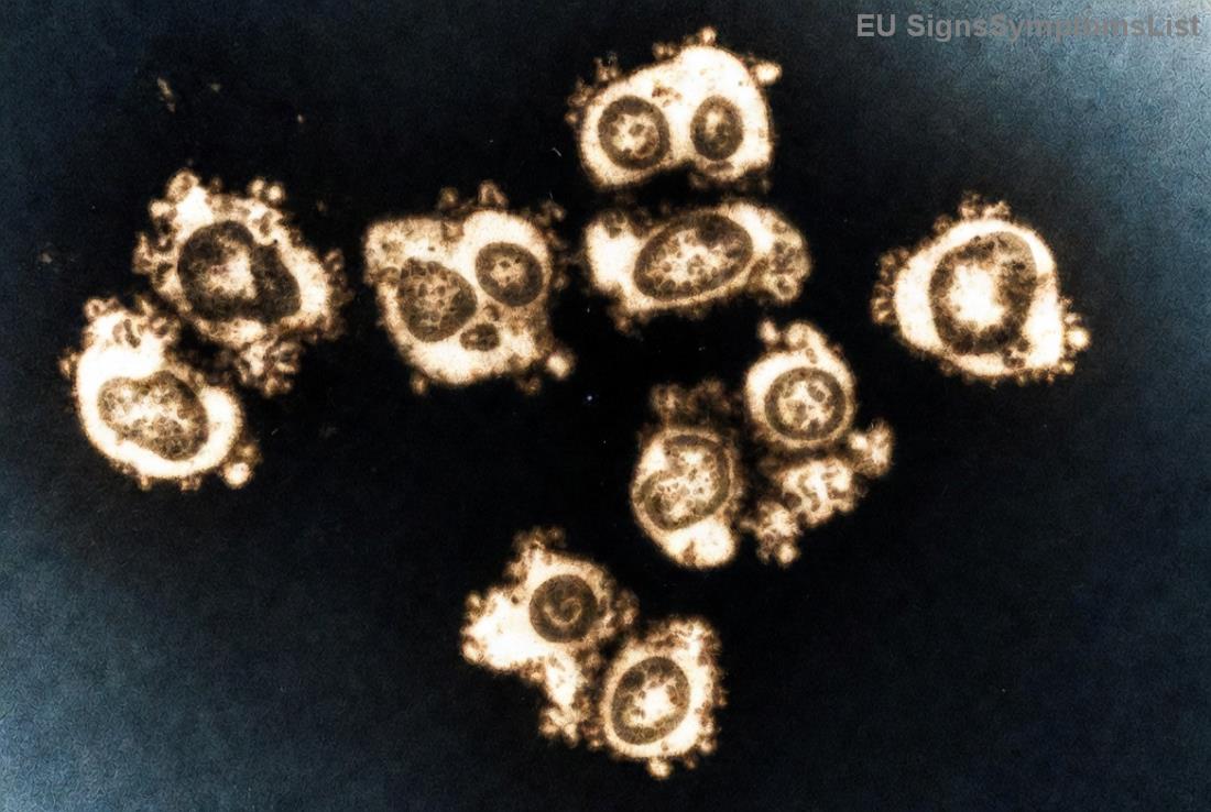 Lečenje i oporavak od <strong>NMIBC</strong> raka mokraćnog mehura