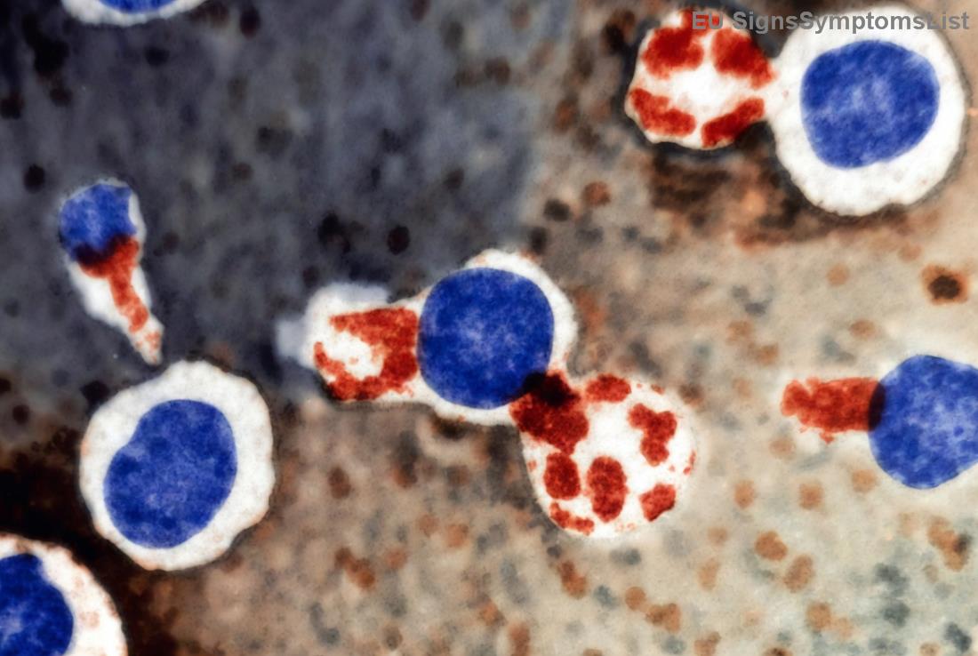 Στάδια επανεισαγωγής τροφίμων στην ανάρρωση οισοφάγου