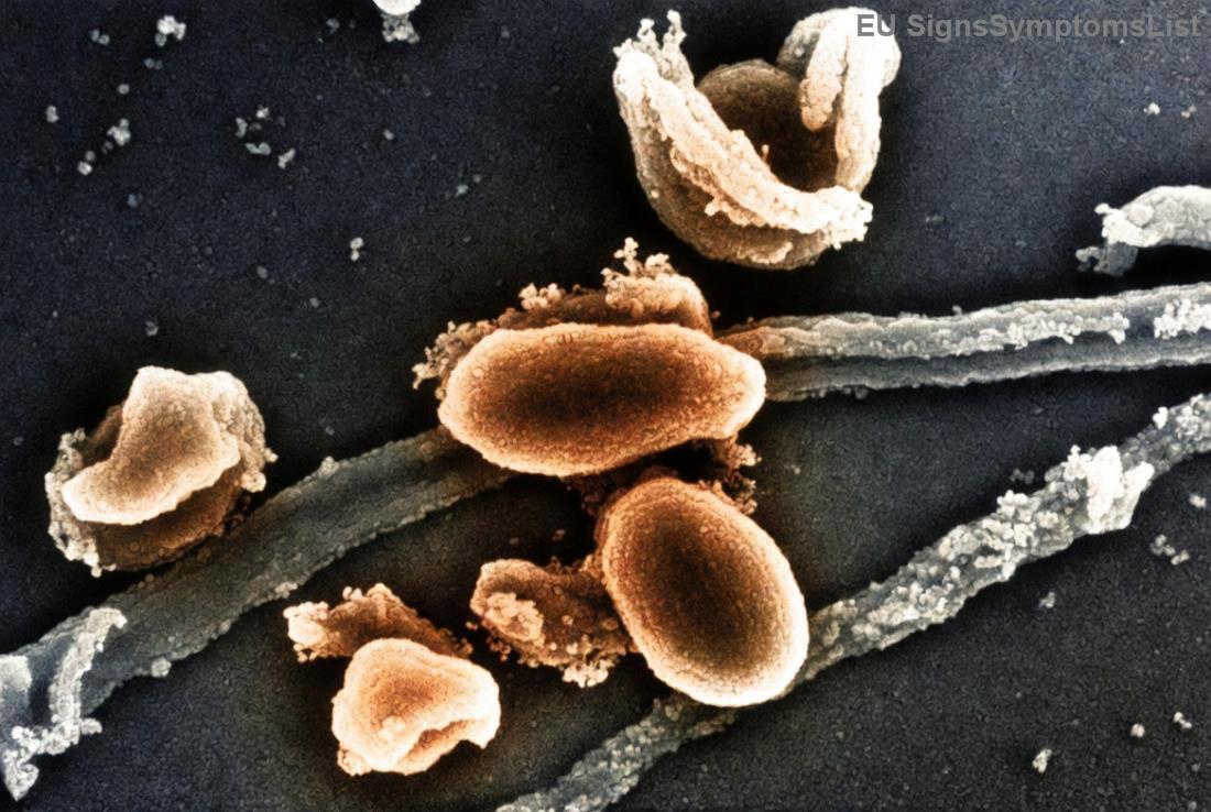 Moderní léčba papilární a folikulární rakoviny štítné žlázy