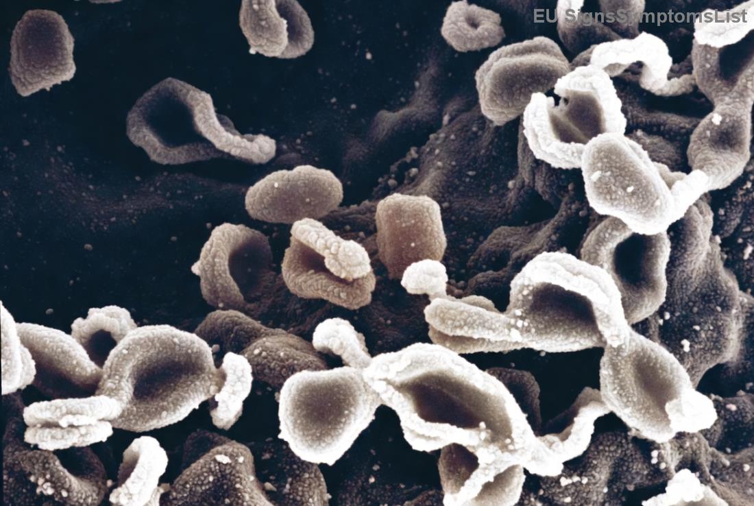 Παράδειγμα μικρών γευμάτων για ενέργεια σε ασθενείς καρκίνου παγκρέατος