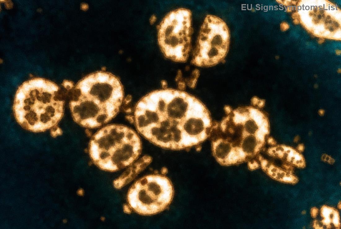 Egészséges ételek petefészekrák táplálkozáshoz