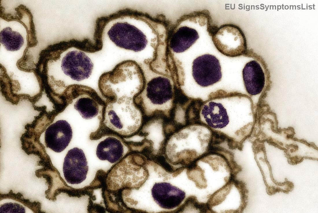 Lifestyle tipy pro podporu při rakovině prostaty