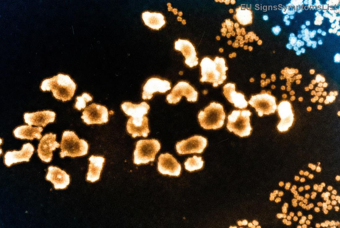 Příklady jídel pro pacienty s Hodgkinovým lymfomem během chemoterapie