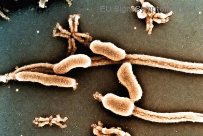 Όγκοι Εγκεφάλου Χαμηλού Βαθμού: Μπορούν να Θεραπευτούν Πλήρως; Ελπίδα & Επιτυχίες ⭐