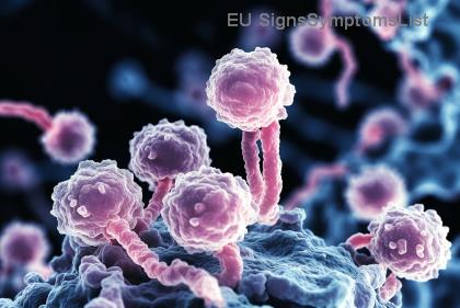 Je raná rakovina žaludku vyléčitelná? Naděje a fakta, která mění životy