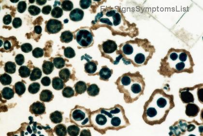 Диета след рак на щитовидната жлеза: Секрети за висок метаболизъм и безкрайна енергия! 💪
