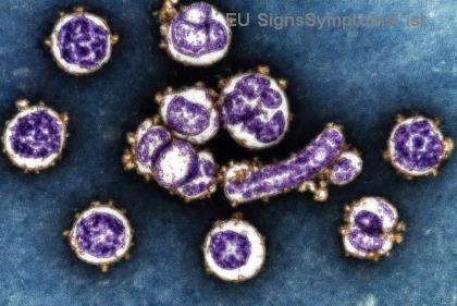 Jak podpořit mladého dospělého s Hodgkinovým lymfomem: Nejlepší průvodce pro pečovatele