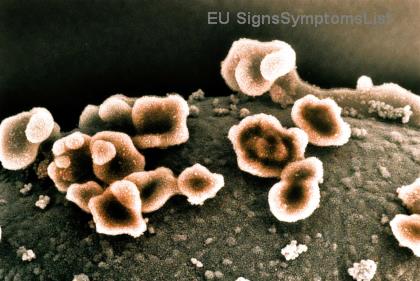 Dijeta za Rak Dojke: Šta Jestiti i Šta Izbegavati za Brži Oporavak Tokom Lečenja! 💪