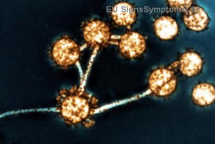 Dijeta za Rak Debelog Creva: Hrana Bogata Vlaknima i Namirnice koje Izbegavajte Nakon Operacije!