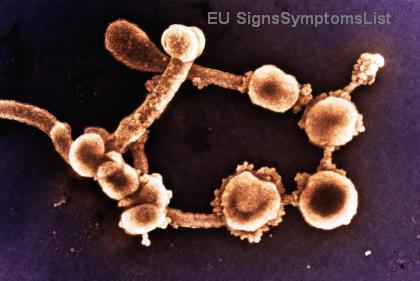 Nyelőcső Rák Étrendje: Puha Ételek és Táplálkozási Tippek Könnyű Nyeléhez – Gyors Megoldások!