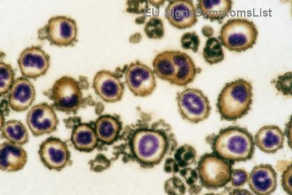 Είναι Θεραπεύσιμος ο Τοπικός Καρκίνος του Νεφρού με Χειρουργική Επέμβαση; ⭐ Η Απάντηση που Σώζει Ζωές!