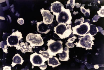 Διατροφή για Καρκίνο του Μαστού: Τι να Τρώτε ΚΑΙ Τι να Αποφύγετε για Ισχυρή Αντοχή στη Θεραπεία! ⭐