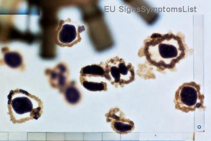 Recepty na nízkójodovou dietu pro léčbu rakoviny štítné žlázy: Chutná jídla, která vás posílí! ⭐