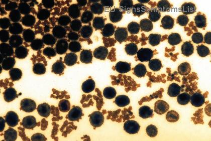 5 Суперхрани за Хранене при Рак на Простатата: Укрепете Здравето и Ускорете Възстановяването!