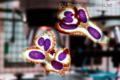 Je chronická lymfocytárna leukémia (CLL) vyliečiteľná? Najnovšie odpovede a nádeje pre pacientov