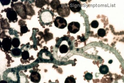 Môže sa štádium 4 rakoviny hrubého čreva s metastázami v pečeni vyliečiť? Najnovšie nádeje a úspešné stratégie