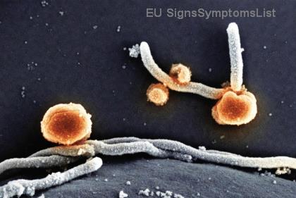 Žijte plnohodnotně s rakovinou prostaty: Změny životního stylu proti příznakům a stresu