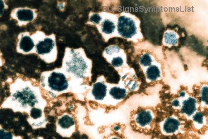 Roli i Ushqimeve Anti-Inflamatore në Rikuperimin nga Melanoma: Si të Forconi Shërimin Natyrshëm! 🌿