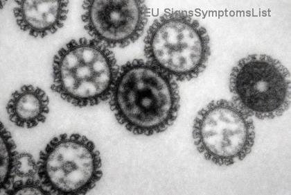 Da li se rak debelog creva u 4. stadijumu sa metastazama na jetru može izlečiti? Moderna nada i uspešni tretmani