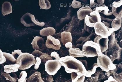 A është Karcinoma Qelizore Skuamoze e Shërueshme në Fazat e Hershme? Fakte Shpresëdhënëse dhe Trajtimet Efektive