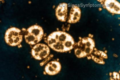 Подкрепяне на Млад Възрастен с Ходжкинска Лимфома: Пълен Ръководител за Грижователите – Ефективни Съвети и Подкрепа