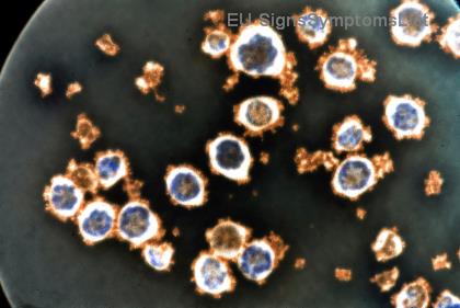 Διαχείριση Παρενεργειών Θεραπείας με Στοχευμένη Διατροφή: Μυστικά για Άνεση και Ενέργεια!