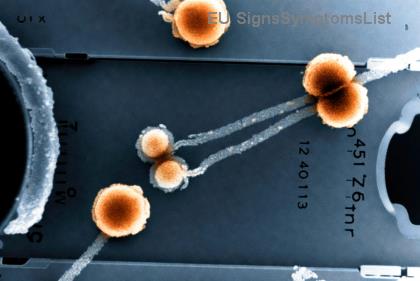 A Është Kanceri i Zorrës së Trashë Stadiumi 3 i Shërueshëm me Kimioterapi? Fakte Shëruese dhe Strategji të Suksesit!